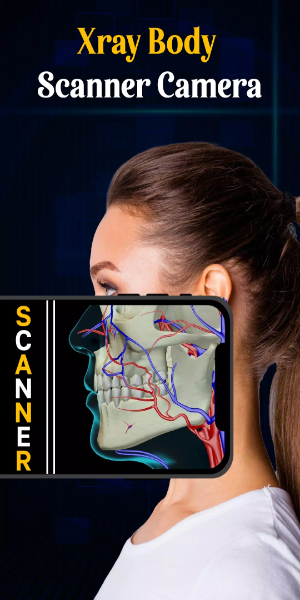 X Ray Mobile v.2.0应用截图第1张